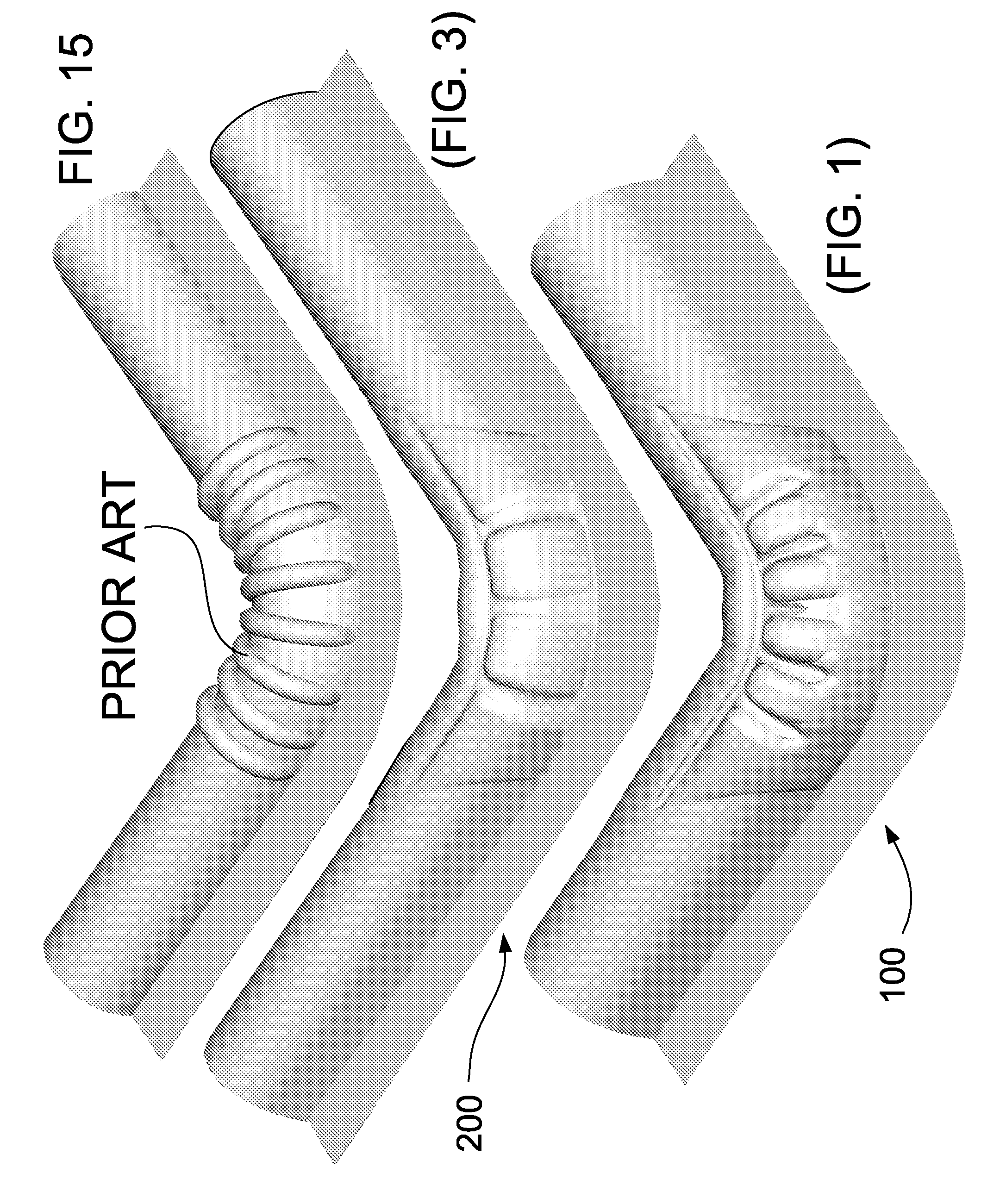 US Patent 7275620 — MTX patented square subwoofer surround corner geometry compared to prior art